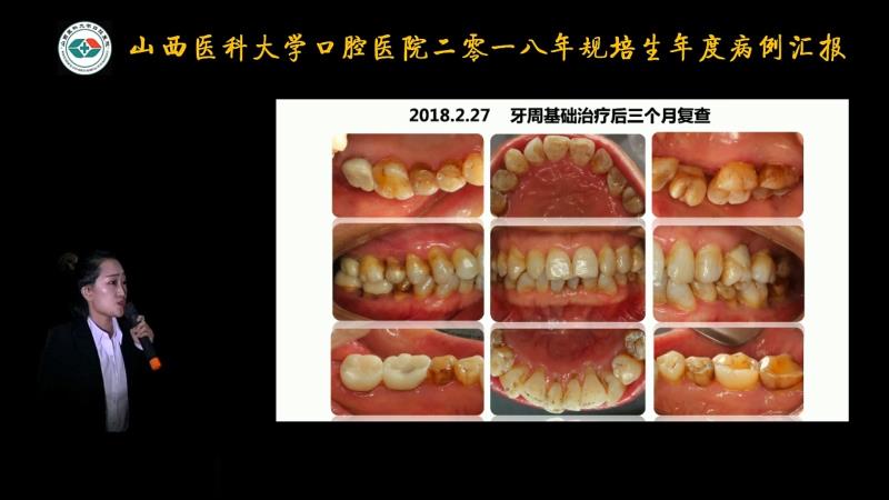 一等獎(jiǎng)選手張麗娜在病例匯報(bào)